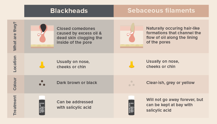 difference between blackheads and sebaceous filaments explained